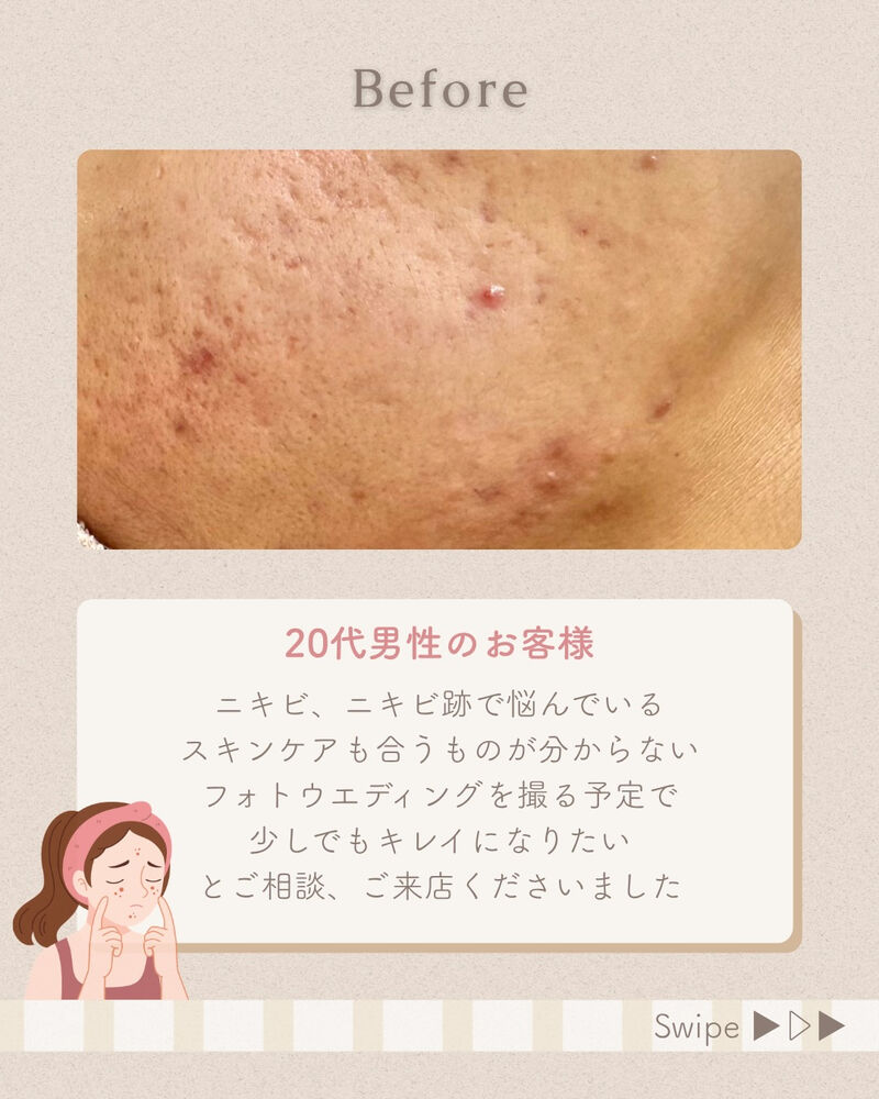 ブログ