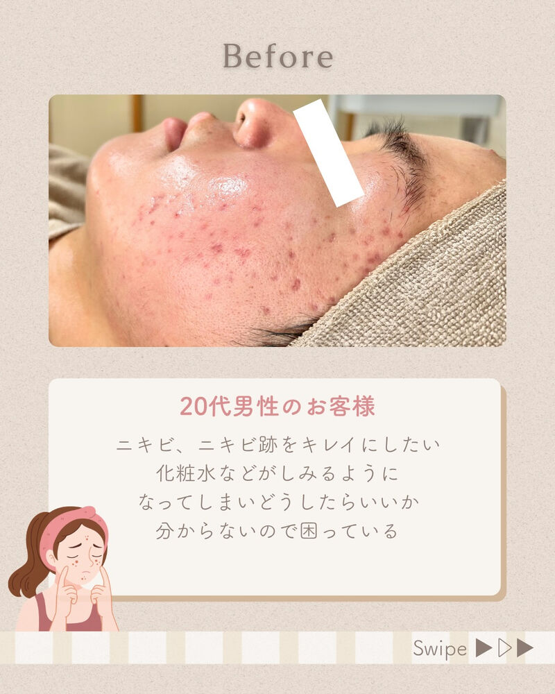 ブログ
