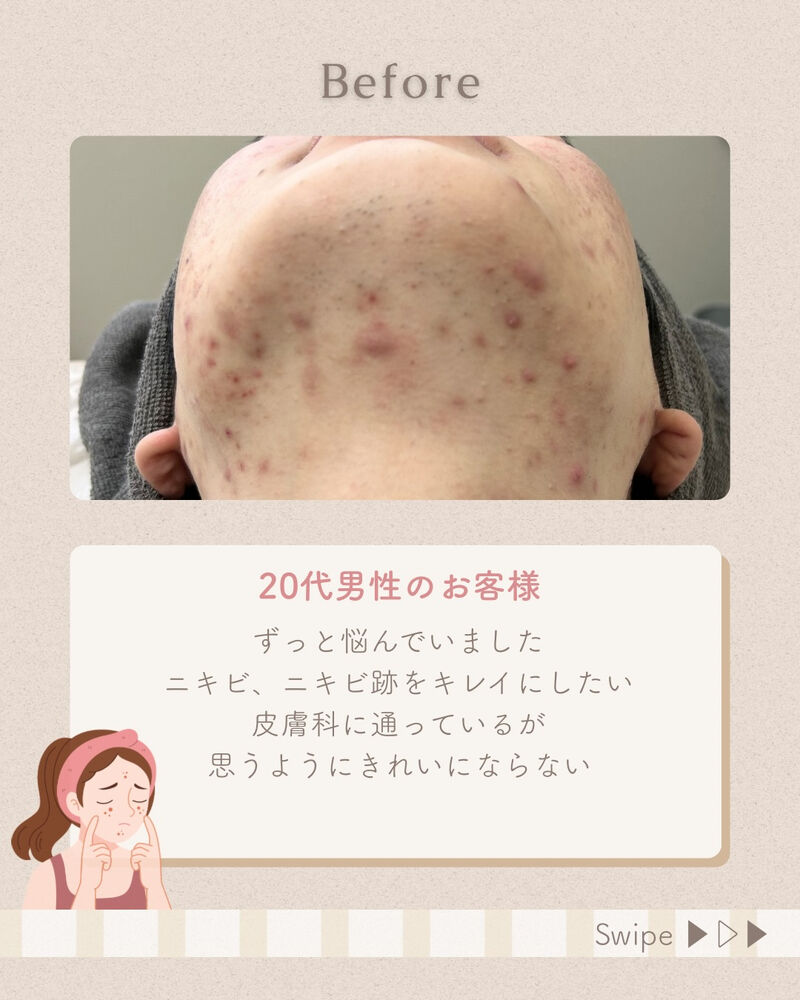 ブログ